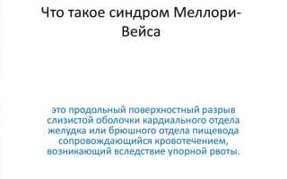 Синдром Меллори-Вейса (Желудочно-пищеводный разрывно-геморрагический синдром)