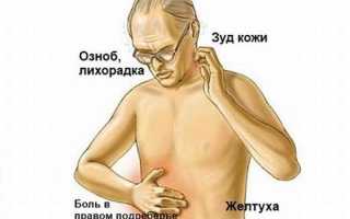 Лечение рака поджелудочной 4 стадии с метастазами народными средствами