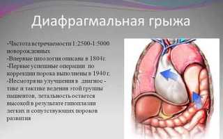 Почему развивается дивертикул двенадцатиперстной кишки и какие могут возникнуть осложнения?