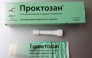 Геморрой: лечение, отзывы о средствах народной медицины