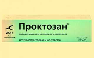 В анальном отверстии что то мешает