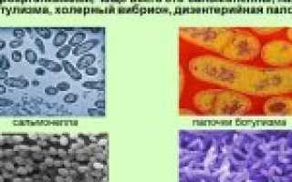 Понос и рвота у ребёнка без температуры — что может быть? Педиатр о 13 возможных болезнях