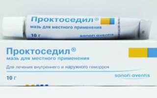 Разрешенные при беременности свечи от геморроя